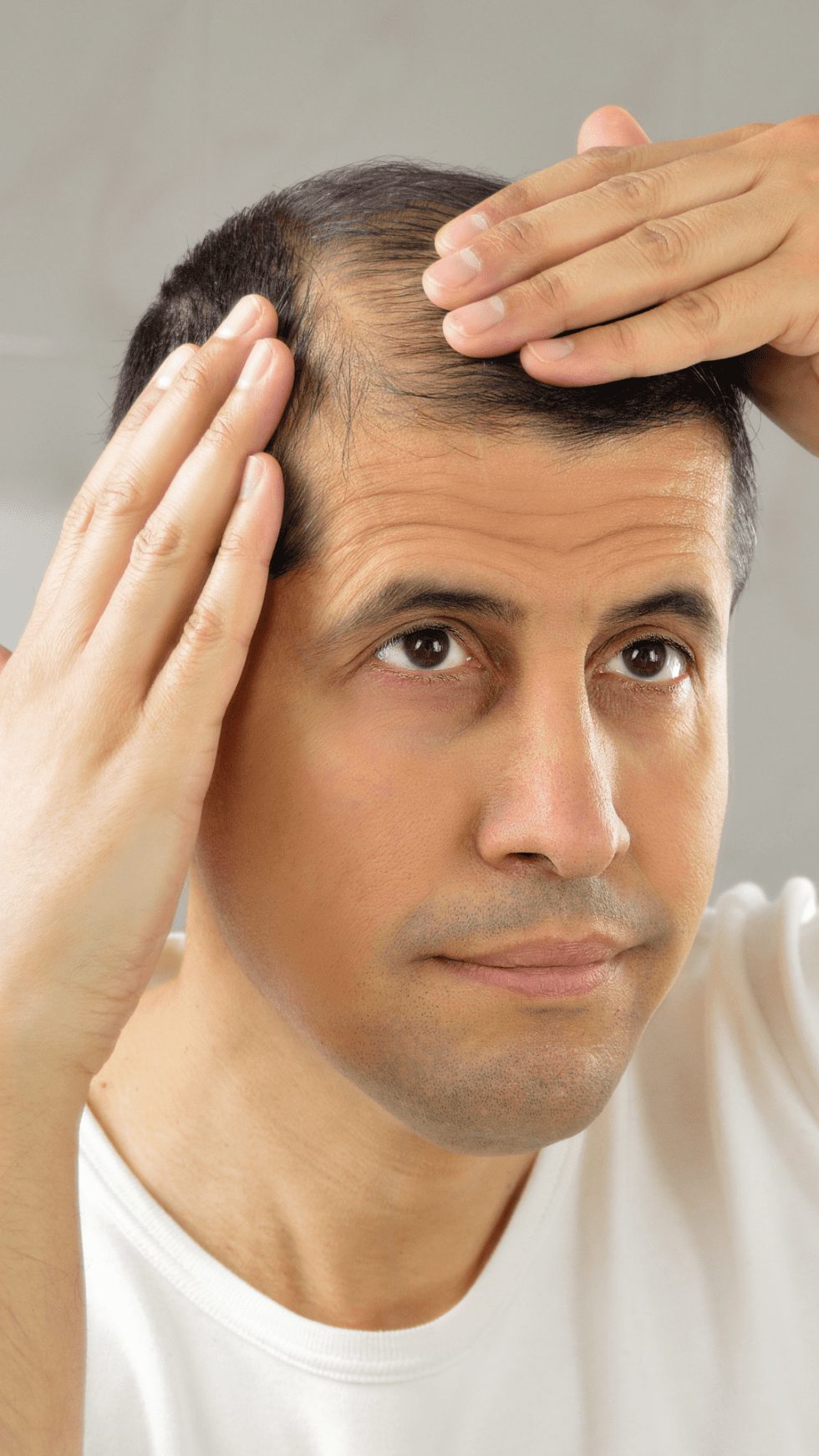 How To Reverse Hair Loss From Medication Antidepressants MHR Clinic