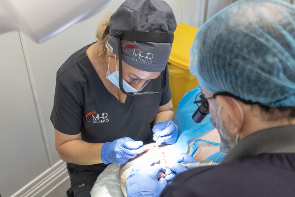 FUE Hair Transplant Manchester MHR Hair Clinic Manchester