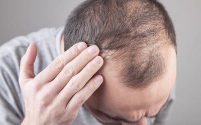 Undo damage done to hair by stress, alcohol & poor sleep patterns
