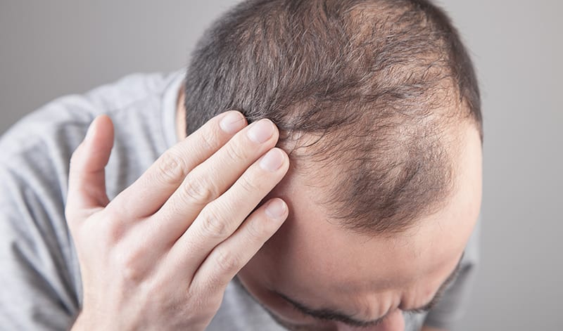 Undo damage done to hair by stress, alcohol & poor sleep patterns