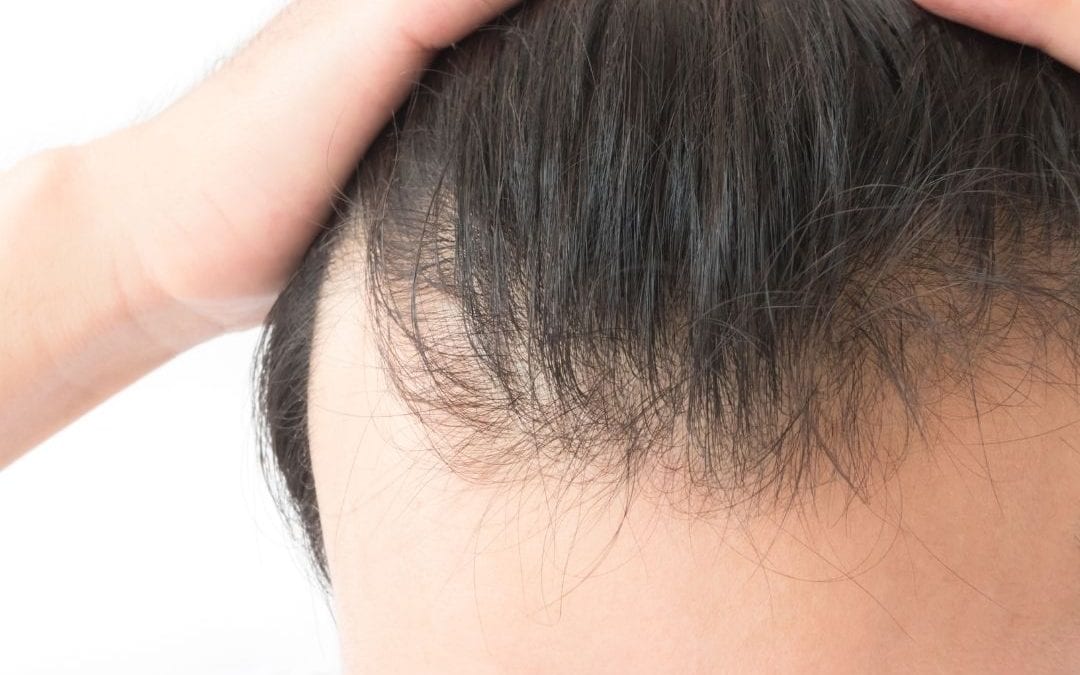 Does long hair cause more hair loss?