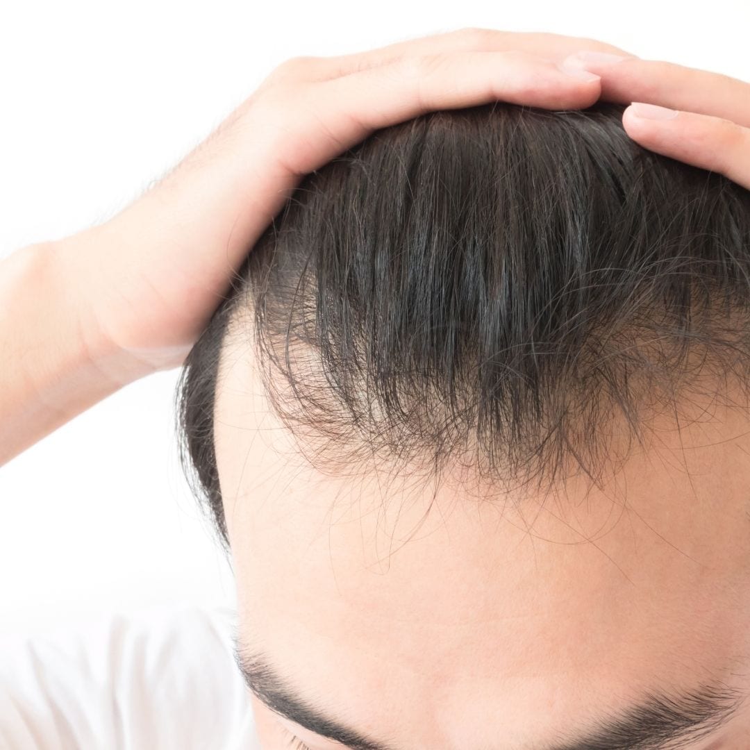 Does Long Hair Cause More Hair Loss MHR Clinic UK
