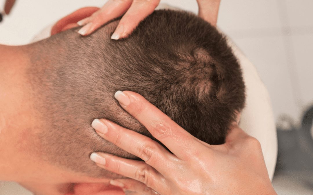 Five ways to make your hair grow faster after a hair transplant
