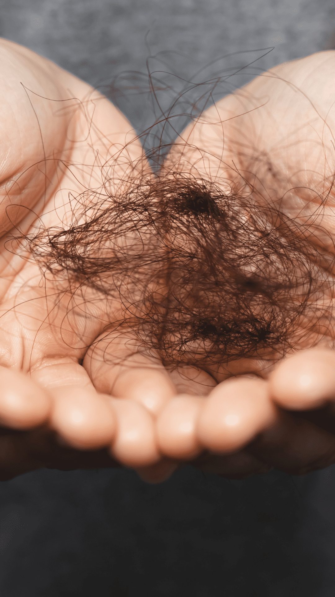 The increase in hair shedding and loss as a result of anti depressant drugs