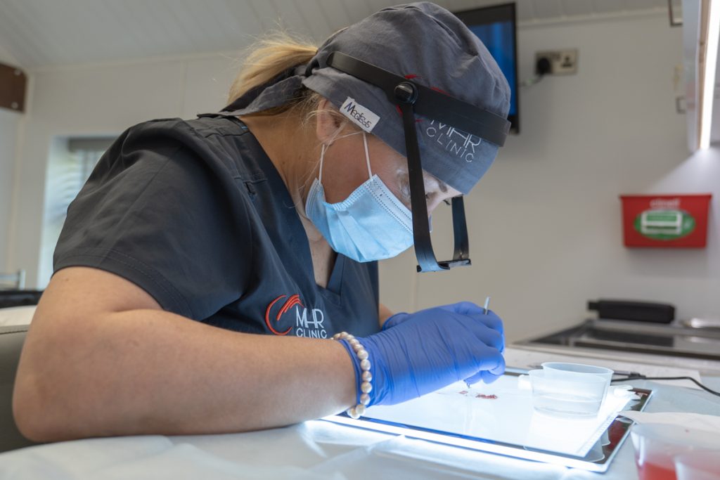 FUE Hair Transplant procedure in Manchester