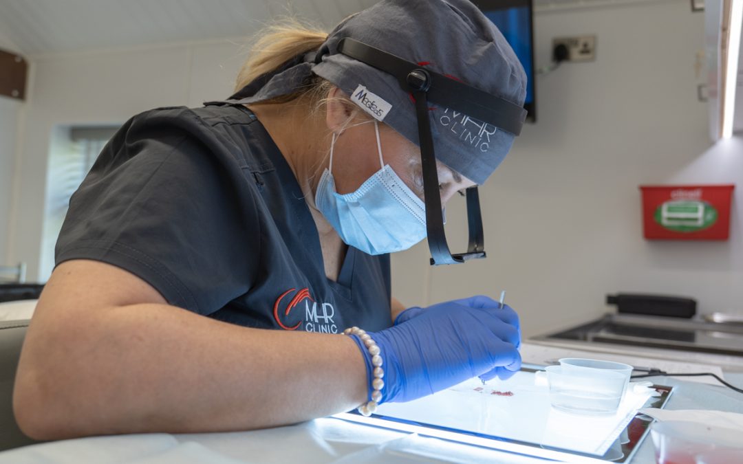 Donor Area Recovery After a Hair Transplant: Healing, Scarring & What to Expect