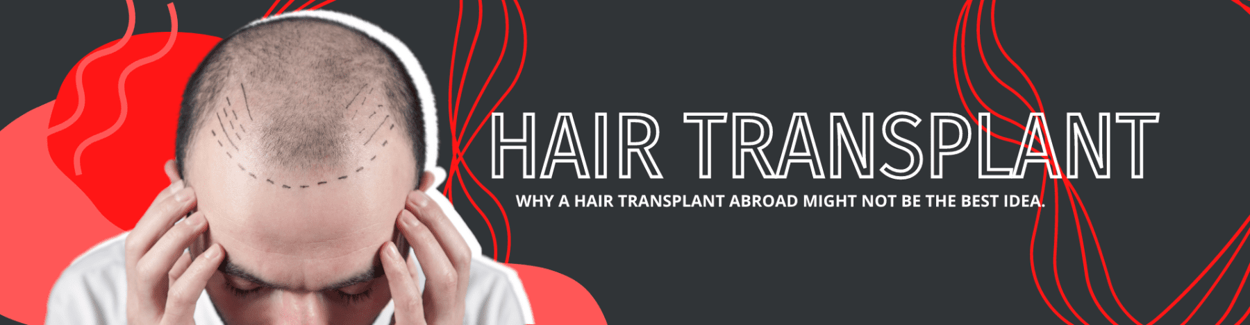 Negatives of a hair transplant abroad
