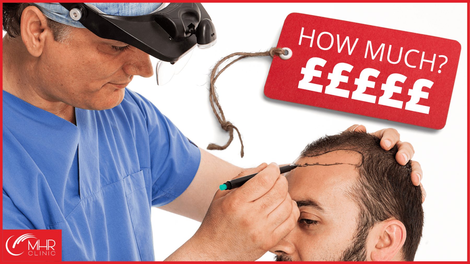 How much is a hair transplant in the UK?