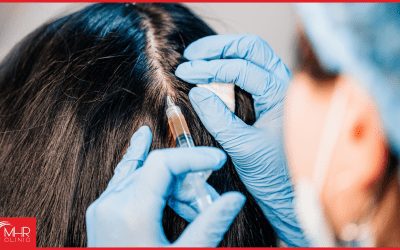 Women & hair transplants | What is different?