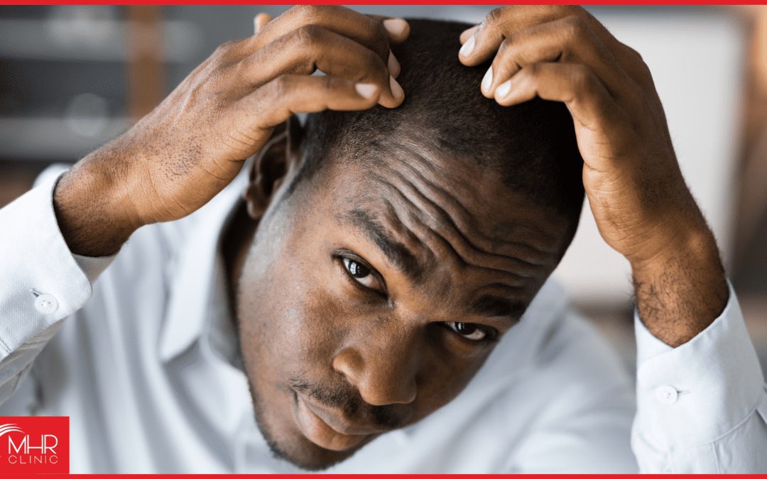 The Emotional Impact of Hair Loss
