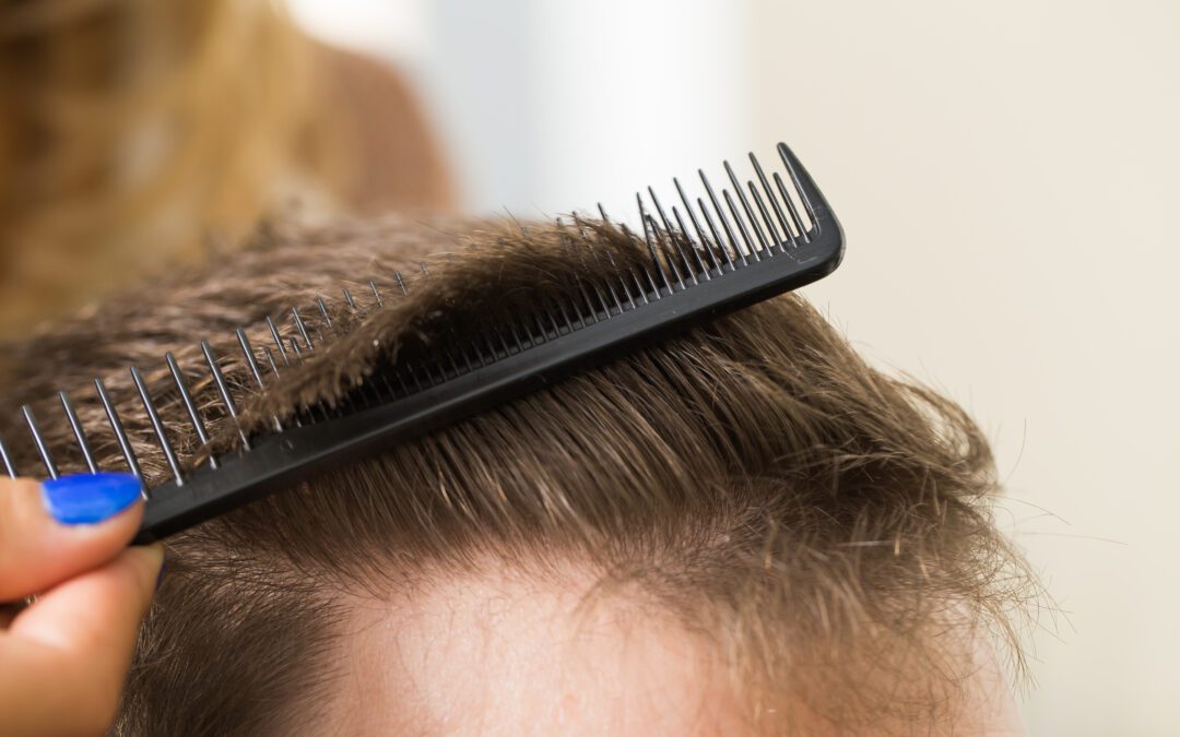 The Different Types of Hair Loss: Causes and Symptoms