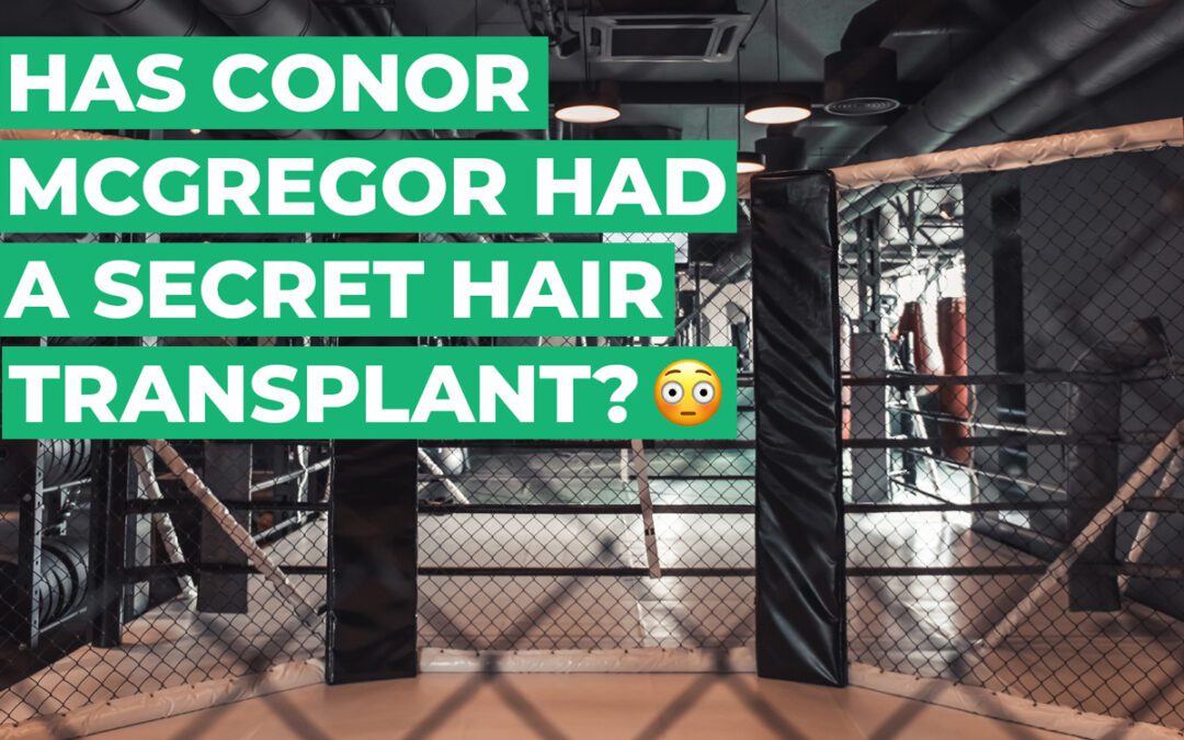 Has Conor McGregor Had a Secret Hair Transplant?