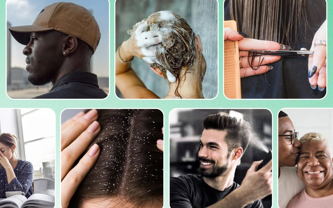 10 Hair Loss Myths – Debunked!