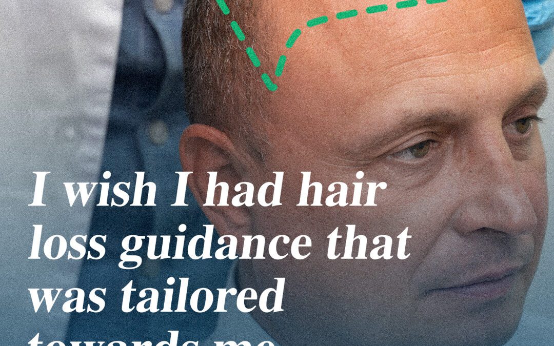 Hair Restoration Journey