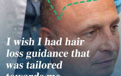 Hair Restoration Journey