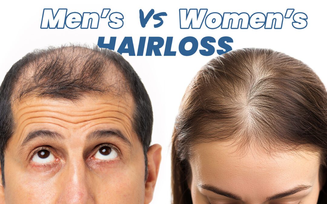 Men vs. Women: How Hair Loss Differs Between Genders