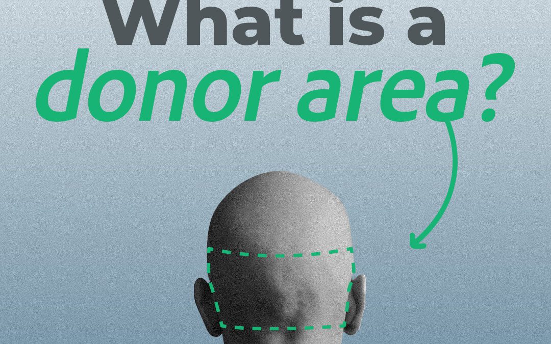 What Is a Donor Area in a Hair Transplant?
