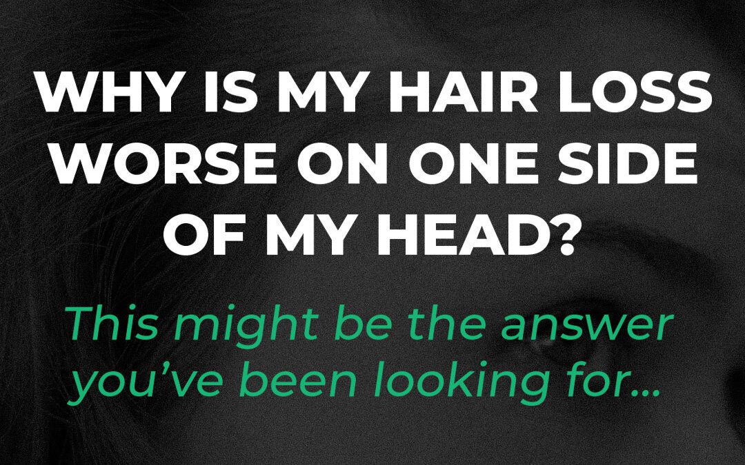 Why Is My Hair Loss on One Side of My Head?