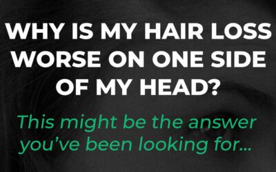 Why is Hair Loss Worse on One Side of My Head?