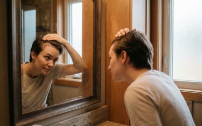 Hair Transplant Recovery Timeline (What to Expect and Tips for Best Care)
